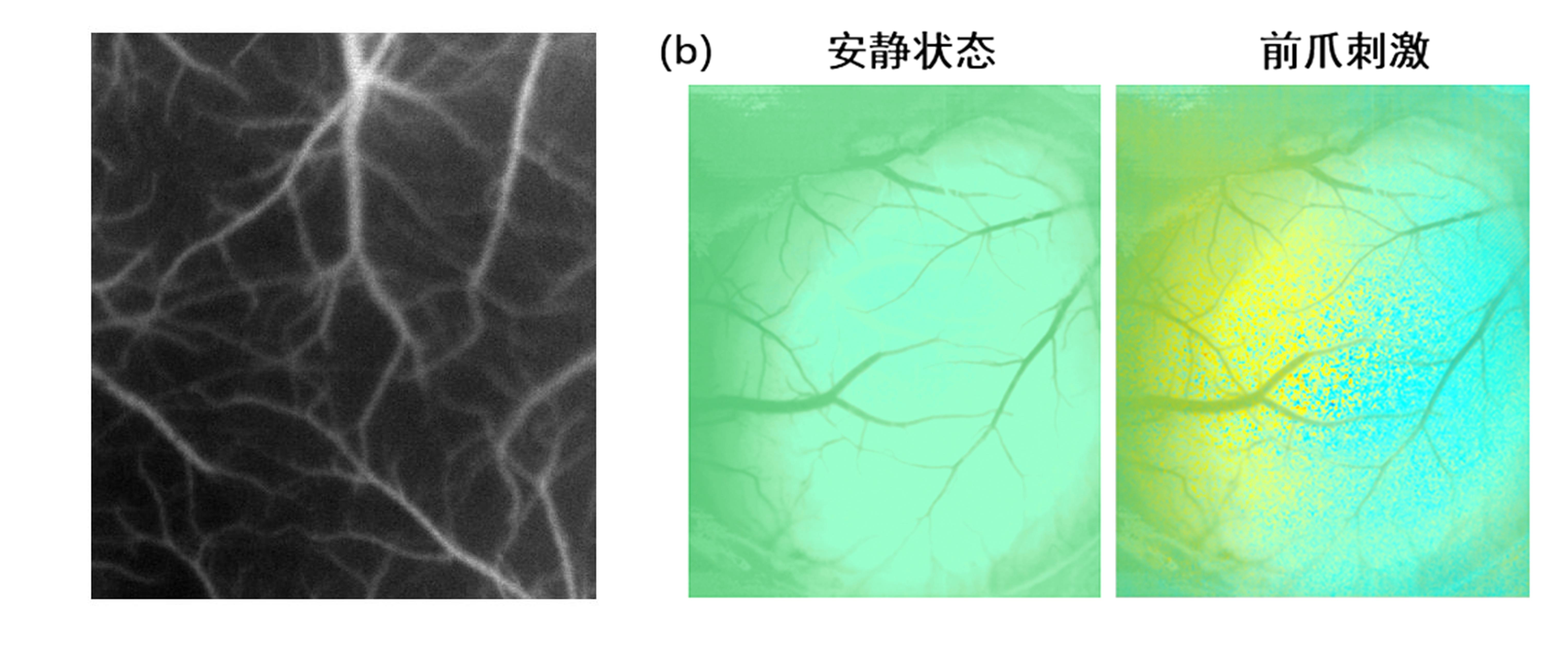 研究方向二:激光动态散斑成像-天津大学-生物医学光子成像实验室